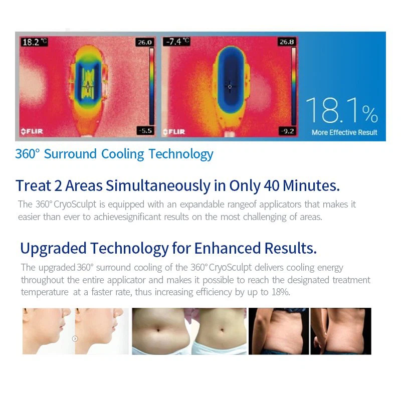 Cryolipolysis fat freezing machine 5