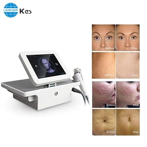 Rf Microneedle Rf Microneedle 기계 살롱 사용 휴대용 분수 Rf 얼굴 리프팅 Microneedle Equipo