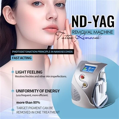 문신 제거 Q 스위치 nd yag 레이저